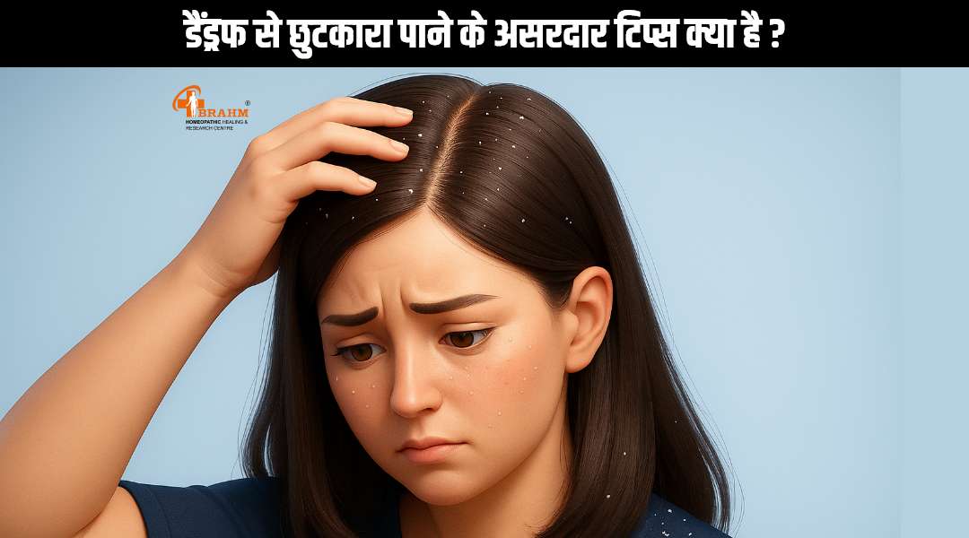dandruff ka homeopathy me ilaaj | rusi ka ilaaj