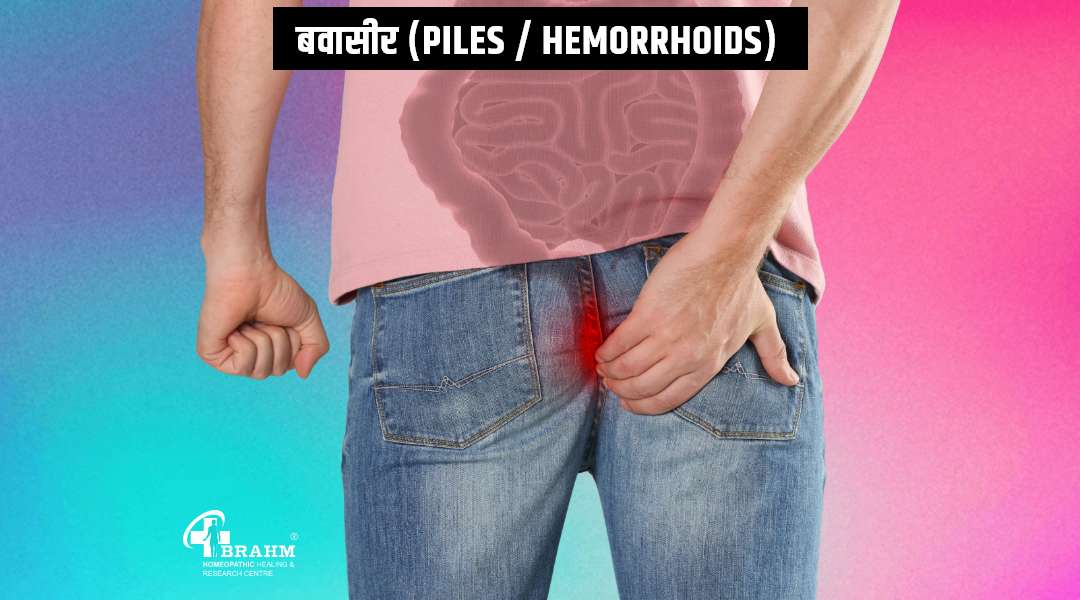 piles treatment in homeopathy | piles ka ilaaj 