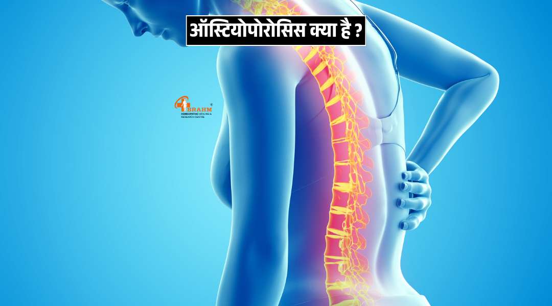 osteoporosis kya  hai? kis ke karan se hota hai? 