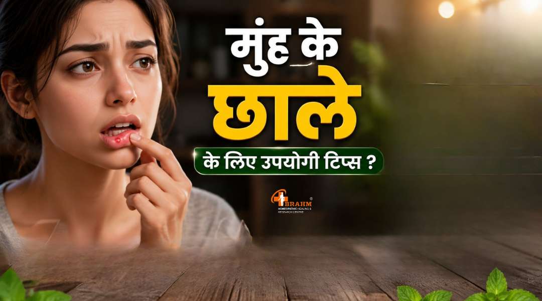 Mouth Ulcers ke liye kya upyogi tips hai?