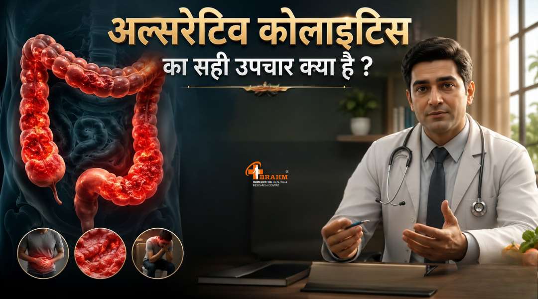 Ulcerative Colitis ka sahi upchar?