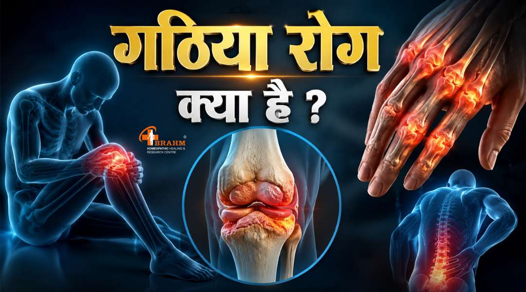 gathiya rog kya hai? homeopathy me ilaj?