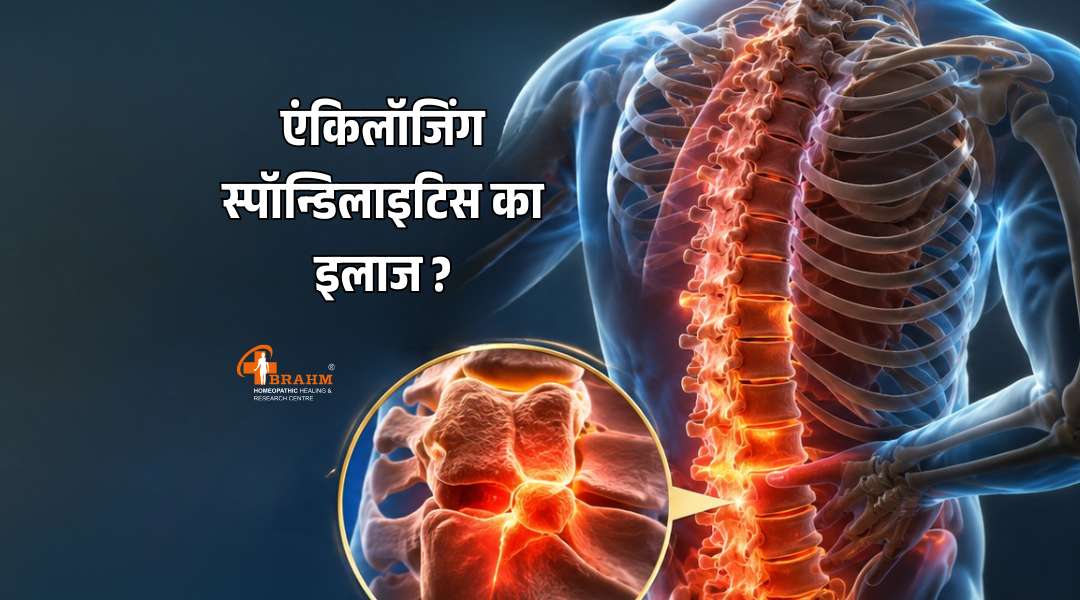 ankylosing spondylitis hone par tips?