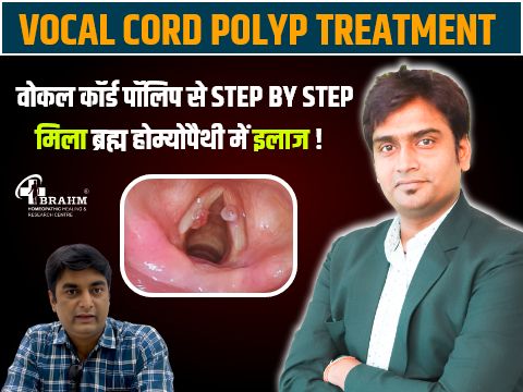 vocal cord polyp ka homeopathy me ilaaj