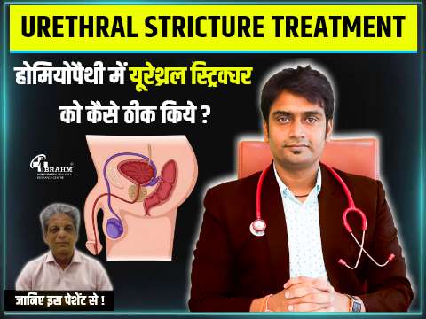 urethral stricture treatment in homeopathy