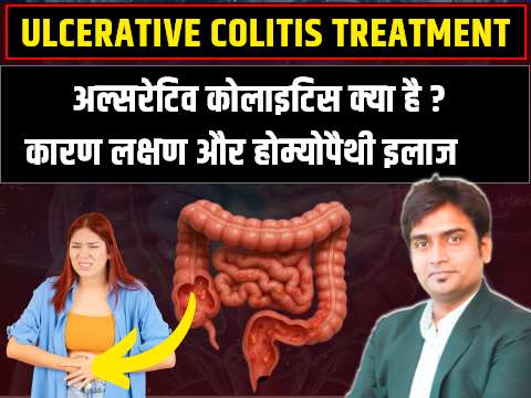 ulcerative colitis ka upchaar 