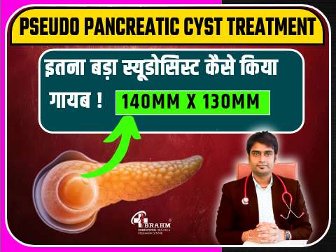 pseudo pancreatic cyst treatment in homeopathic