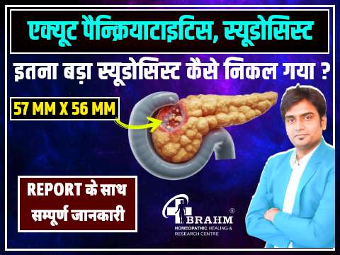 pancreatic pseudocysts treatment in homeopathic
