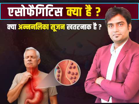 esophagitis treatment in homeopathy