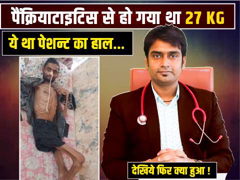 acute necrotizing pancreatic kya hota hai