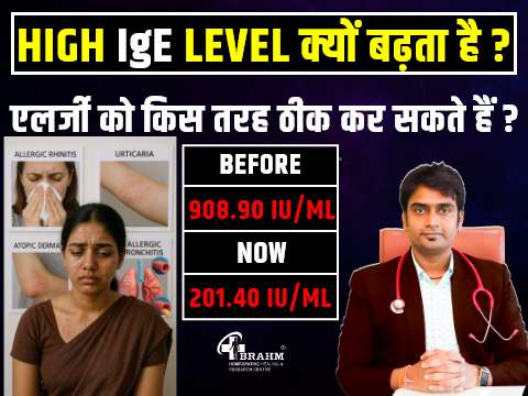 high ige level kyu increase hota hai