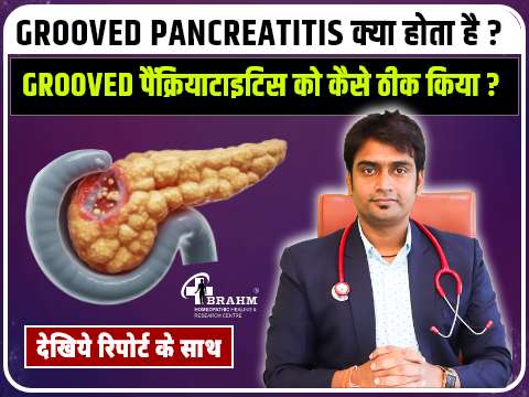 grooved pancreatic treatment in homeopathy
