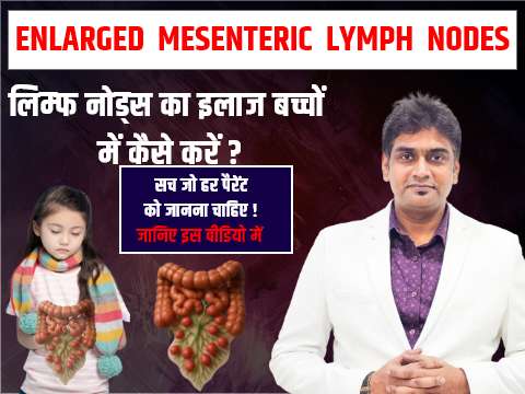 bacho me enlarged lymph node ka ilaaj