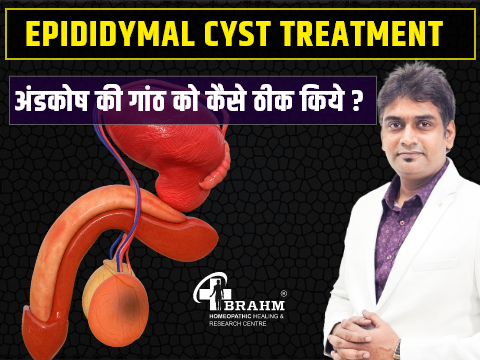 epididymal cyst treatment in homeopathy