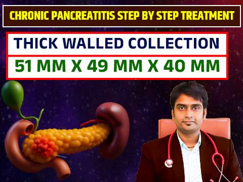 chronic pancreas kya hai