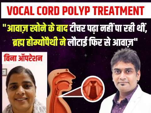 homeopathic me vocal cord nodules ka ilaaj