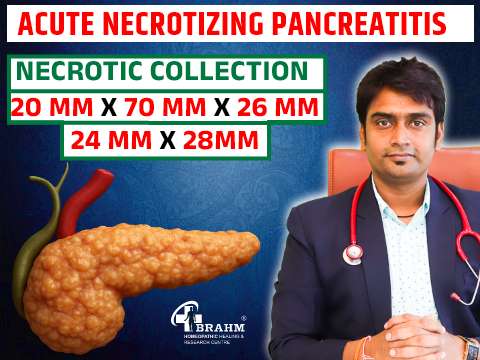 acute necrotizing ka homeopathic me ilaaj