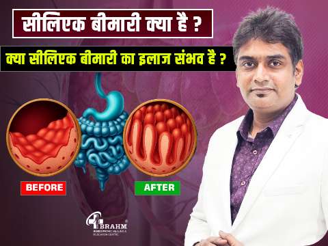 celiac bimari ka homeopathic ilaj