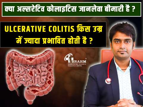 homeopathy me ulcerative colitis ka ilaaj