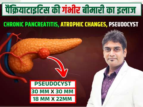 Pancreatitis Atrophy treatment in homeopathy