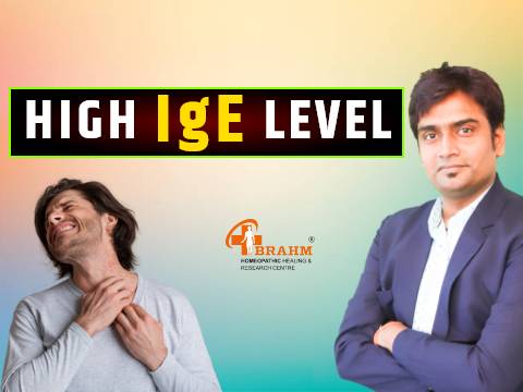 Urticaria Treatment In Hindi
