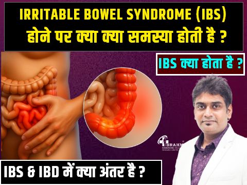 ibs kya hai or iske kya laksan  hote hai