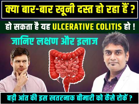 kya baar baar khuni dast hona ulcerative colitis ho sakta hai?
