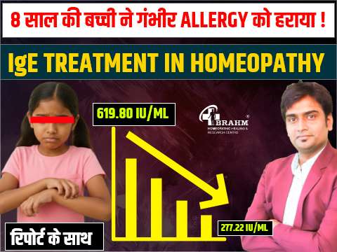 IGE ke badhne ka homeopathy me kya ilaj hai ?