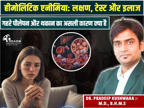 Hemolytic Anemia ka homeopathy me ilaj