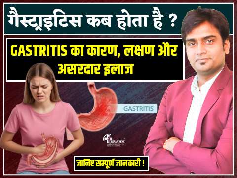 Gastritis kab hota hai | Gastritis Hone Ka homeopathy me ilaj