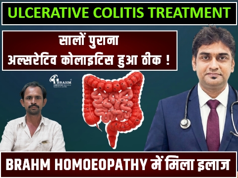 ulcerative colitis ka  homeopathic me kya  ilaaj hai?