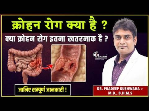 Crohn's rog ka kya ilaj hai