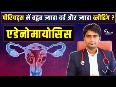 homeopathic me adenomyosis ka ilaj?