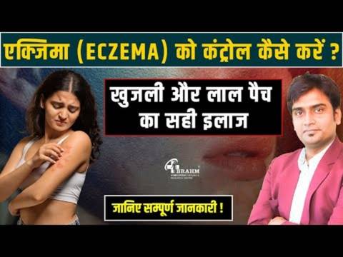 homeopathy me atopic dermatitis ka ilaj?
