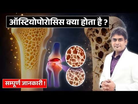 haddiyon ki kamjori kya hai or kyu hoti hai?