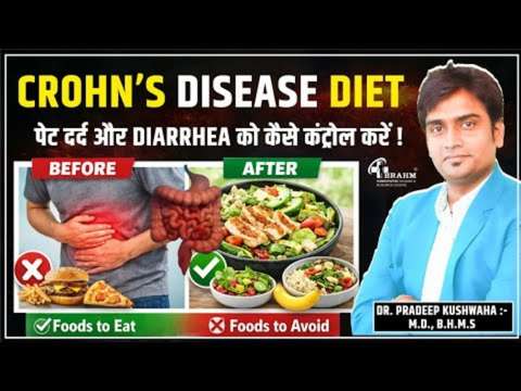 Crohn’s Disease ka ilaj or sahi diet plan