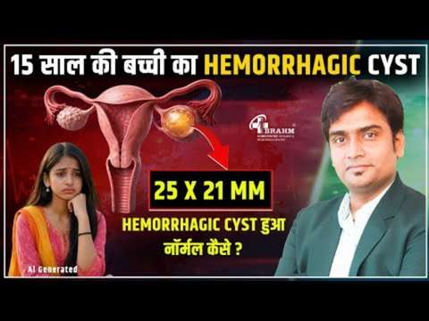 Hemorrhagic Cyst kaise hota hai ? kya laksan hote hai?