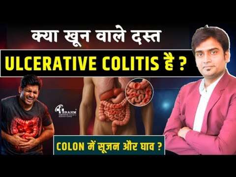 ulcerative colitis hone ke kya vajah hota hai?
