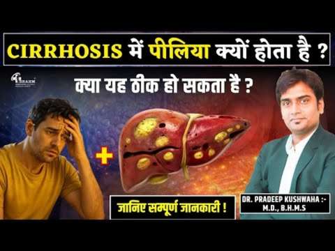 Cirrhosis me piliya sahi ho sakta hai?