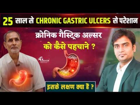 Chronic Gastric Ulcer ka homeopathy me ilaj?