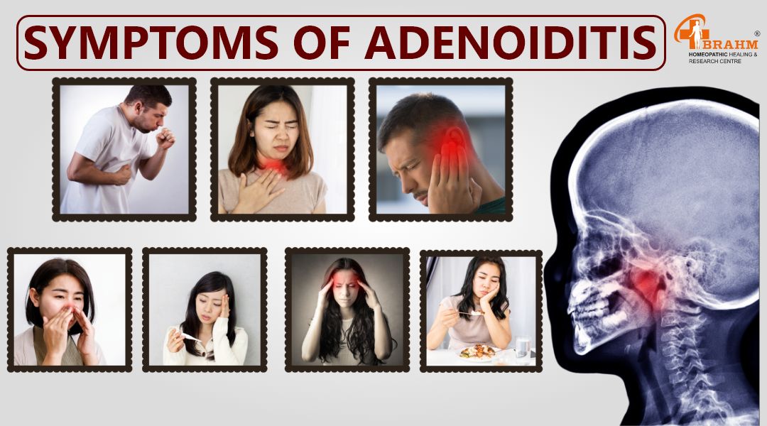 adenoiditis-symptoms