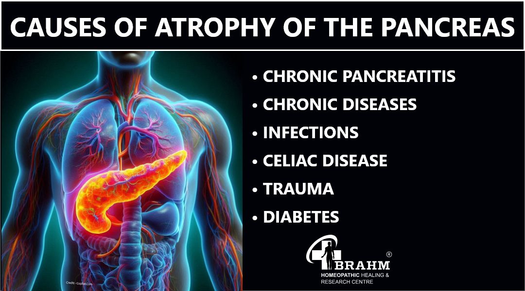 Causes-of-Atrophy-of-the-Pancreas