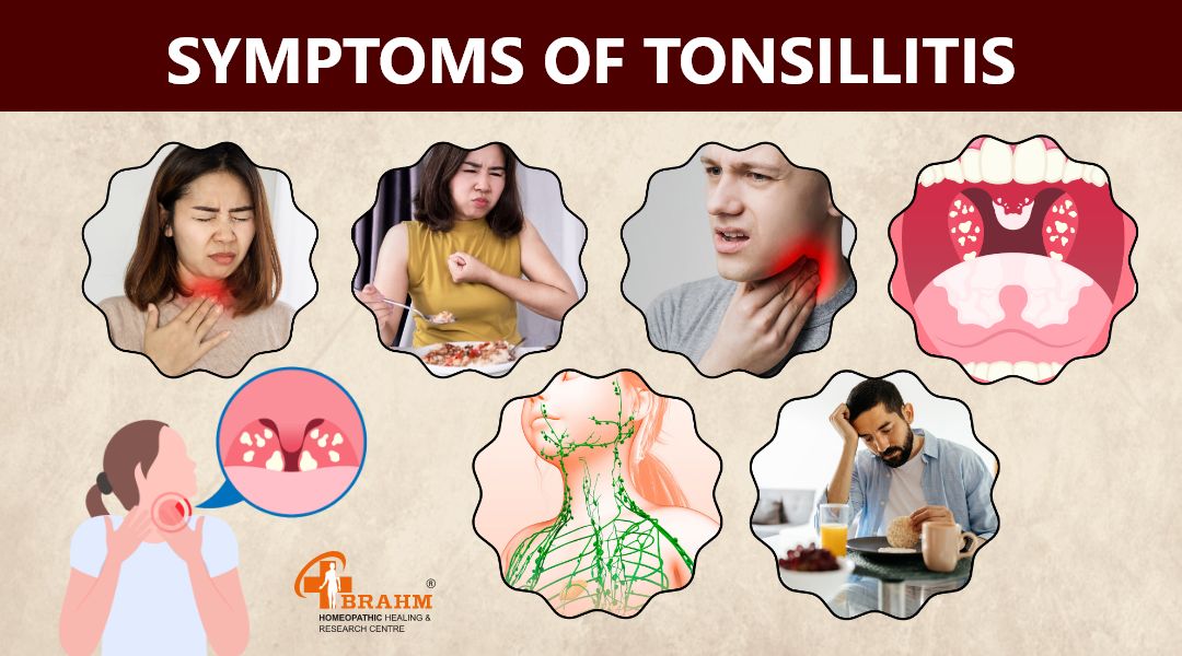 Symptoms-of-Tonsillitis