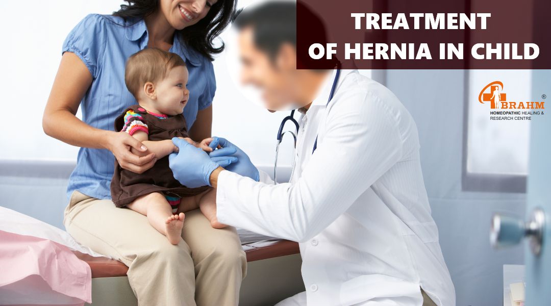 Treatment-of-hernia-in-child