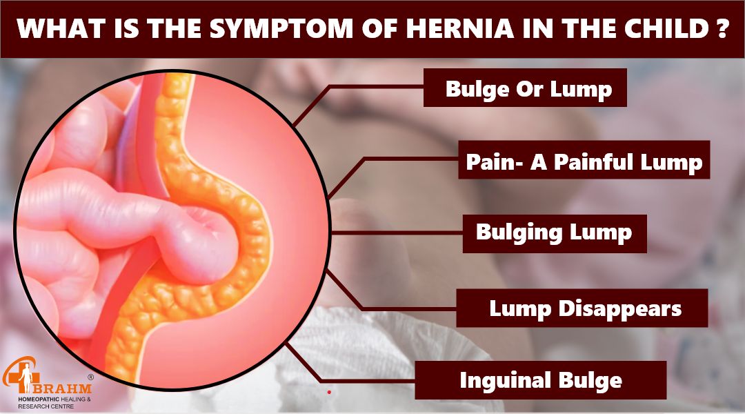 What-is-the-symptom-of-hernia-in-the-child