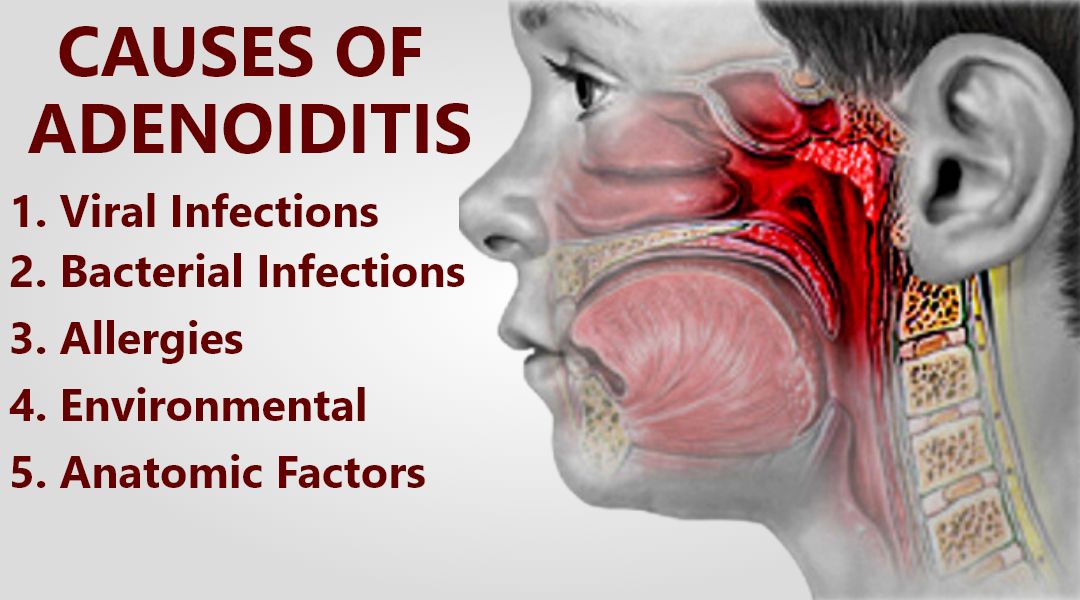 adenoiditis-cause