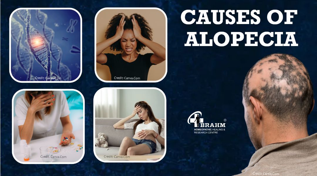 cause-of-alopecia