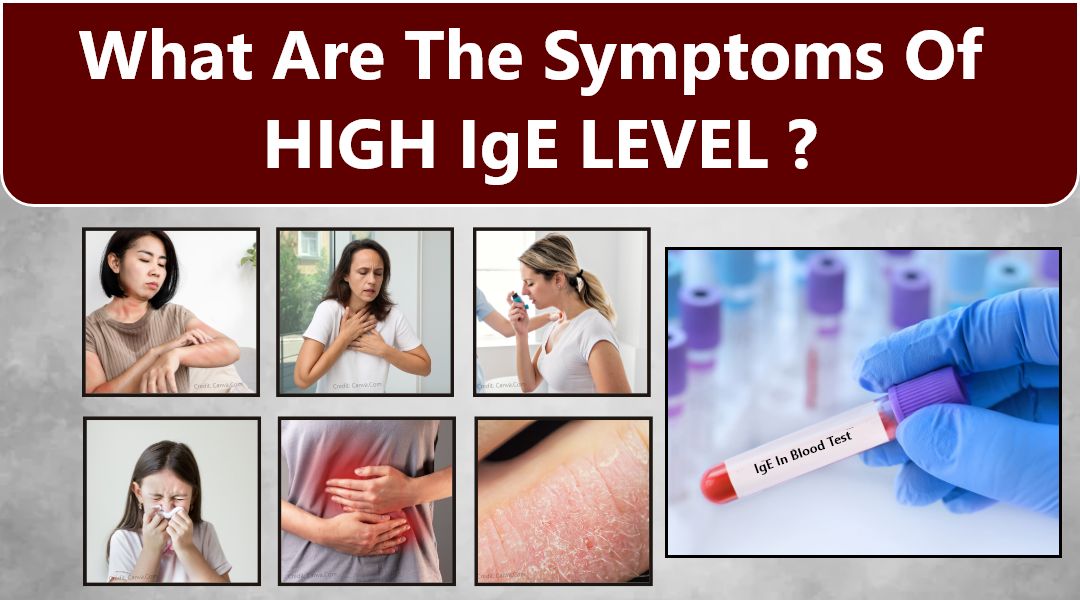 symptoms-of-ige-in-blood