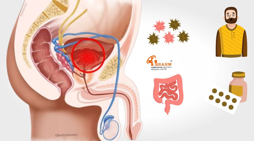 causes of prostatitis 