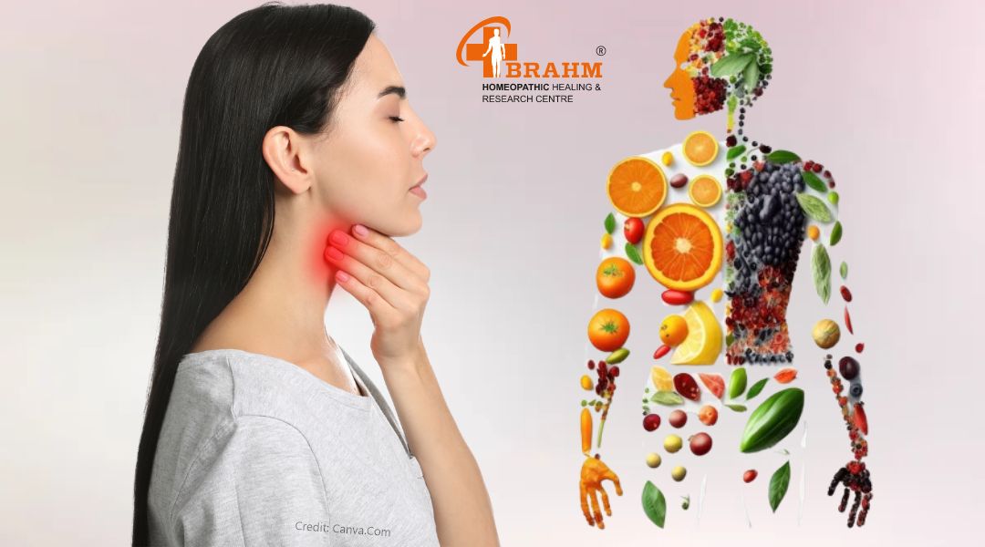 diet plan for goiter